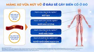 Tại sao cần kiểm soát mỡ máu